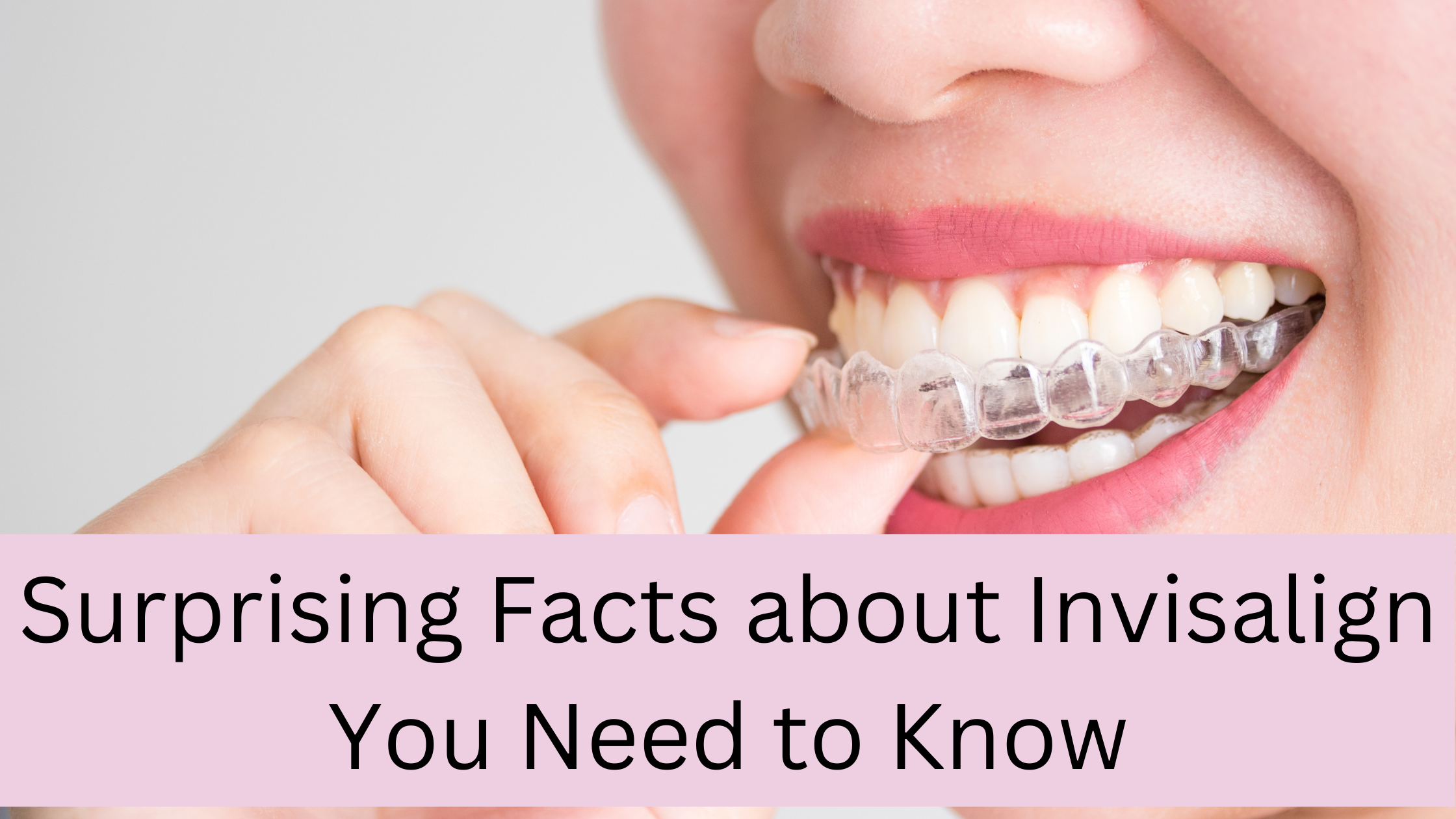 Dental Questions: Can I eat with my Invisalign trays on?